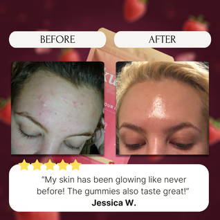 Glutathione Beauty Gummies